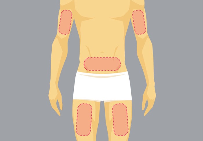 Select and prepare injection site