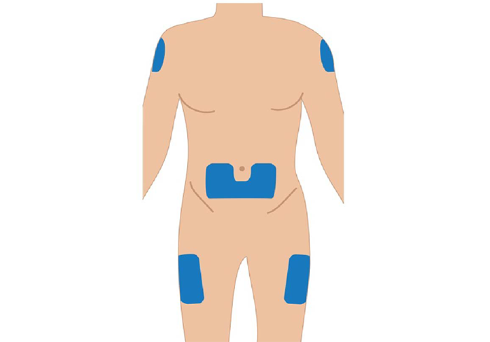 Select and prepare the injection site